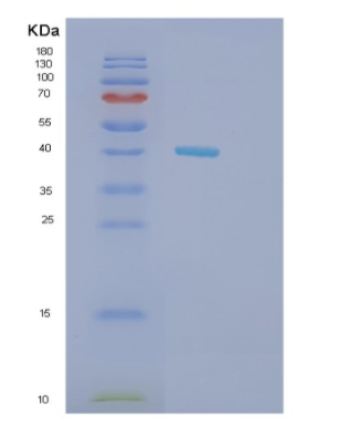 Recombinant Mouse Hdac8 Protein