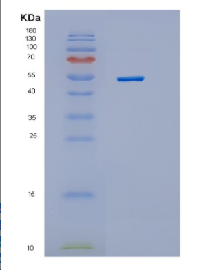 Recombinant Human Hexokinase 4 Human Protein