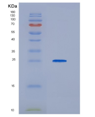 Recombinant HCV-E2 Protein