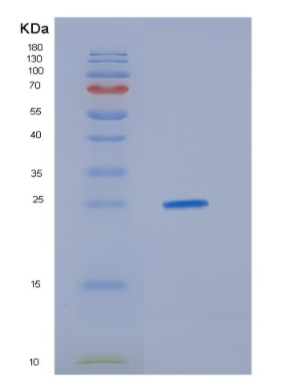 Recombinant Human HDGFRP3 Protein