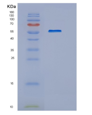 Recombinant Human HEXA Protein