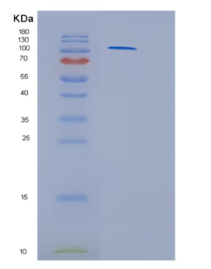 Recombinant Human Hexokinase 3 Human Protein