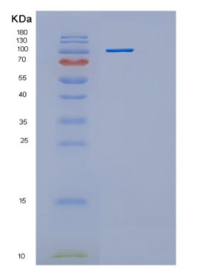 Recombinant Human Hexokinase 2 Human Protein