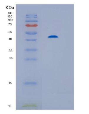 Recombinant Human His-PP2Cα(His-tagging Protein phosphatase 2C) Protein