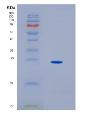Recombinant Human HLA-DOA Protein