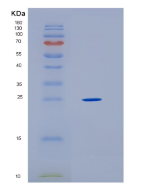 Recombinant Human HLA-DRB1 Protein