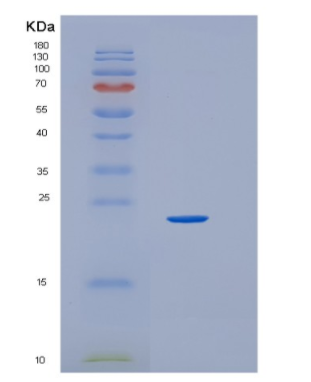 Recombinant Human HEBP1 Protein