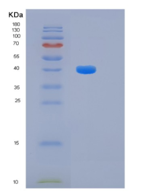 Recombinant Human HIBCH Protein