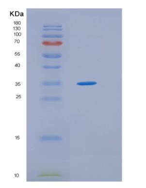 Recombinant Human HLF Protein