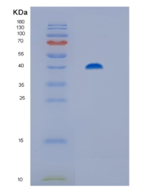 Recombinant Human Hip/ST13 Protein