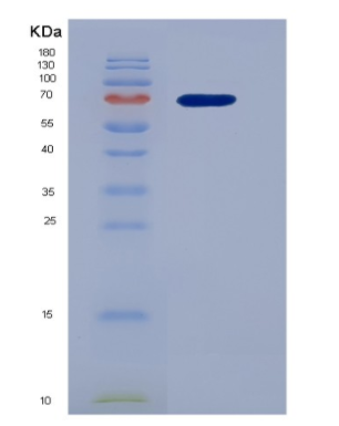 Recombinant Hepatocyte Growth Factor (HGF)