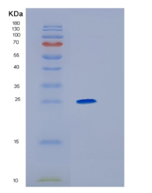 Recombinant Human HLA-DOB Protein