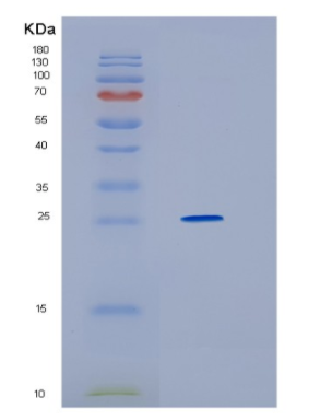 Recombinant Human HMGB2 Protein