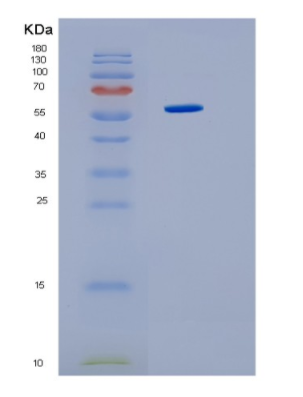 Recombinant Human HMGCS1 Protein