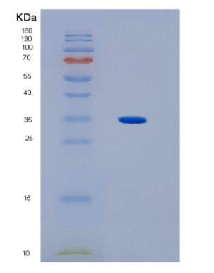 Recombinant Human HLA-C Protein