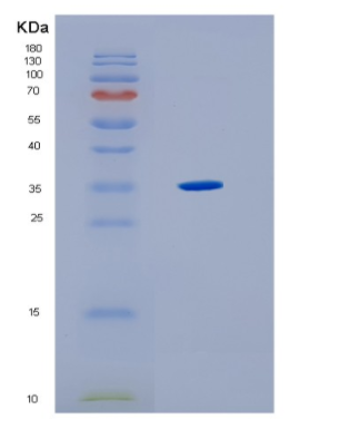 Recombinant Human HLA-F Protein