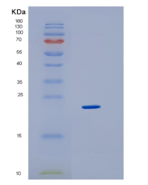 Recombinant Human HMGB3 Protein