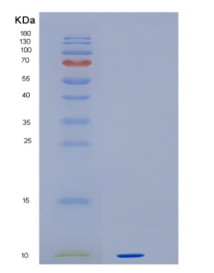 Recombinant Human HMGN3 Protein