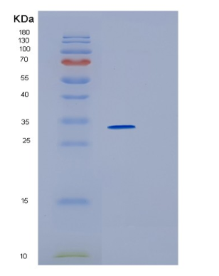 Recombinant Human HMOX2 Protein