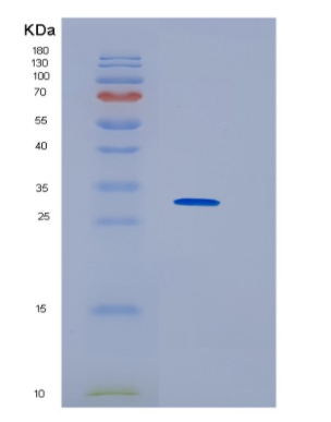 Recombinant Human HNRNPK Protein