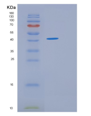 Recombinant Human HOMER3 Protein