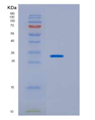 Recombinant Human HOXB13 Protein