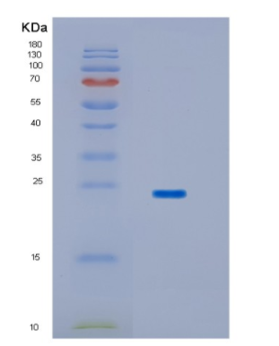 Recombinant Human HPCAL1 Protein