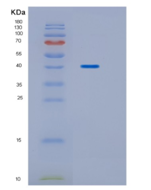 Recombinant Human HPD Protein