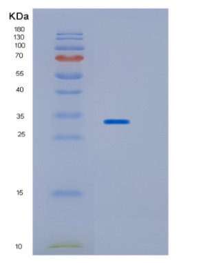 Recombinant Human HPGD Protein