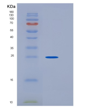 Recombinant Human HPGDS Protein