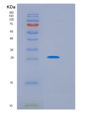 Recombinant Human HPRT1 Protein