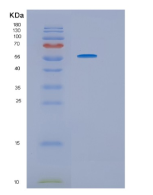 Recombinant Human HRS (Histidyl-tRNA synthetase) Protein