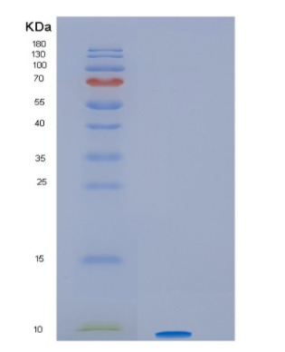 Recombinant Human HSBP1 (Heat shock factor binding protein 1) Protein