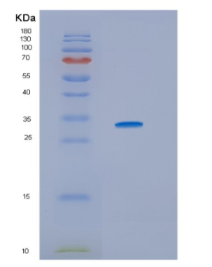 Recombinant Human HSD17B10 Protein