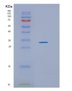 Recombinant Human HSD17B11 Protein