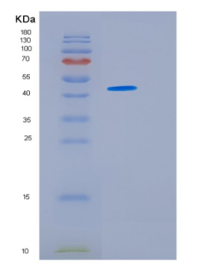 Recombinant Human HSFY1 Protein