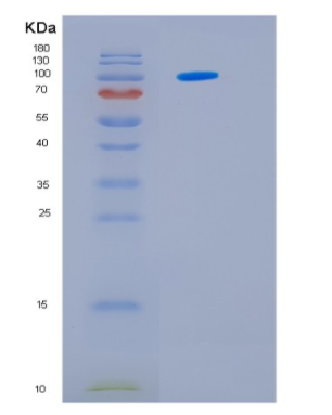 Recombinant Human HSP105α 1-858 aa Protein