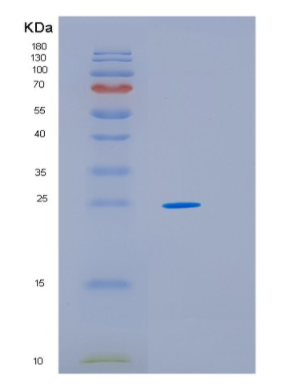 Recombinant Human HSP27 Protein