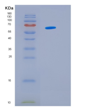 Recombinant Human HSP60 Protein