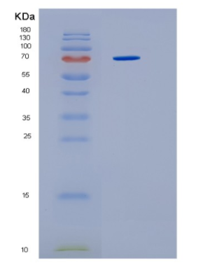 Recombinant Human HSP70 (amino acids 1-641) Human Protein