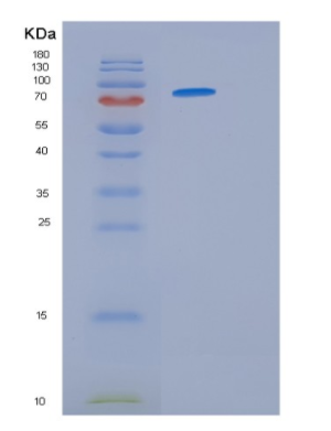 Recombinant Human HSP90 (amino acids 1-732) Protein