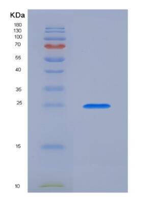 Recombinant Prorelaxin 1 (REL1)