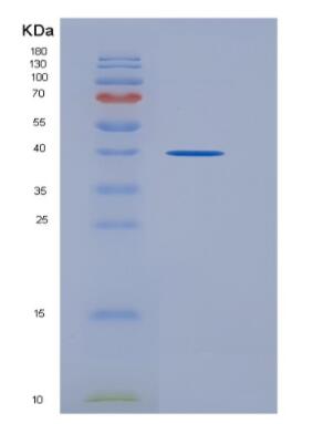 Recombinant Mouse Wingless Type MMTV Integration Site Family, Member 5A (WNT5A) Protein