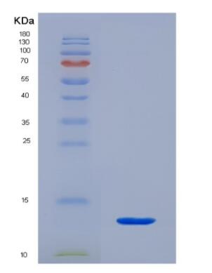 Recombinant Neuregulin 4 (NRG4)