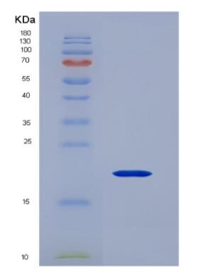 Recombinant Cytochrome P450 1B1 (CYP1B1)