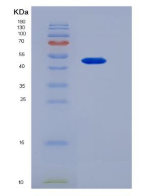 Recombinant Platelet/Endothelial Cell Adhesion Molecule (PECAM1)