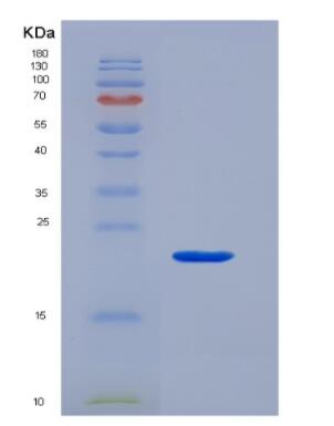 Recombinant Von Willebrand Factor (vWF)