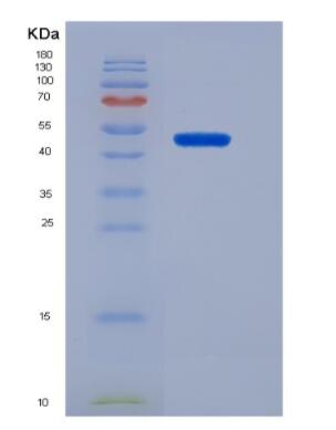 Recombinant Mdm2 p53 Binding Protein Homolog (MDM2)