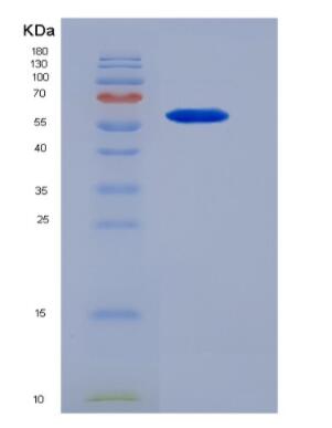 Recombinant Mouse Netrin 1 (Ntn1)