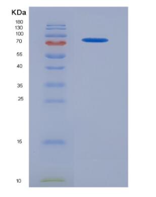 Recombinant Colony Stimulating Factor 1, Macrophage (MCSF)